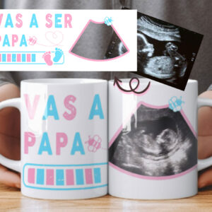 taza-personalizada-ecografia-nina