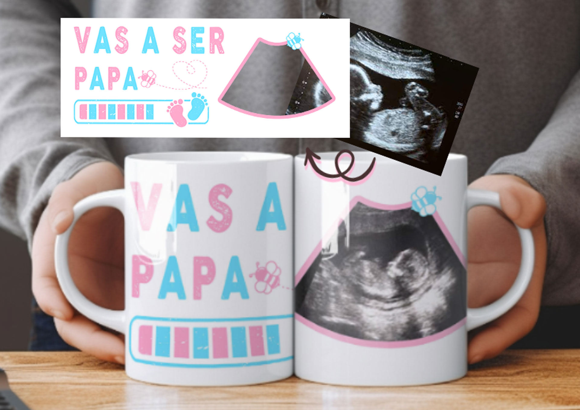 Taza personalizada Ecografía